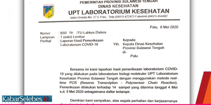 Pusdatina Covid-19 Sulteng Sesalkan Bocornya Hasil Swab dari Laboratorium